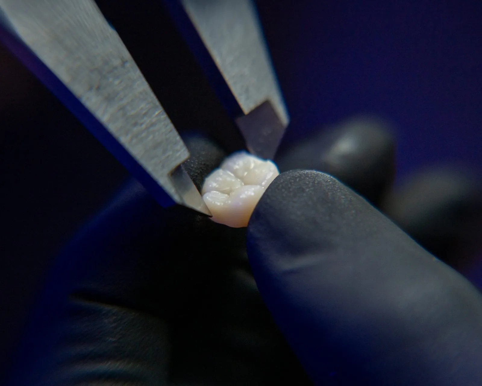 Detalle de una corona dental terminada