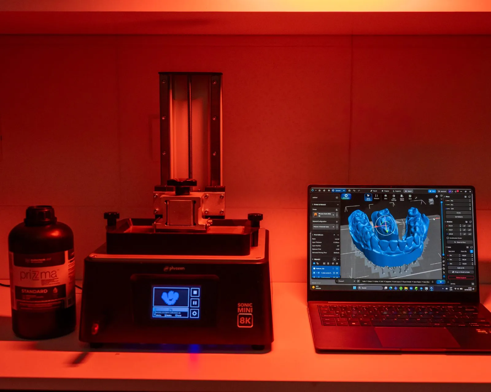 Impresora 3D y software de diseño en el laboratorio de la clínica