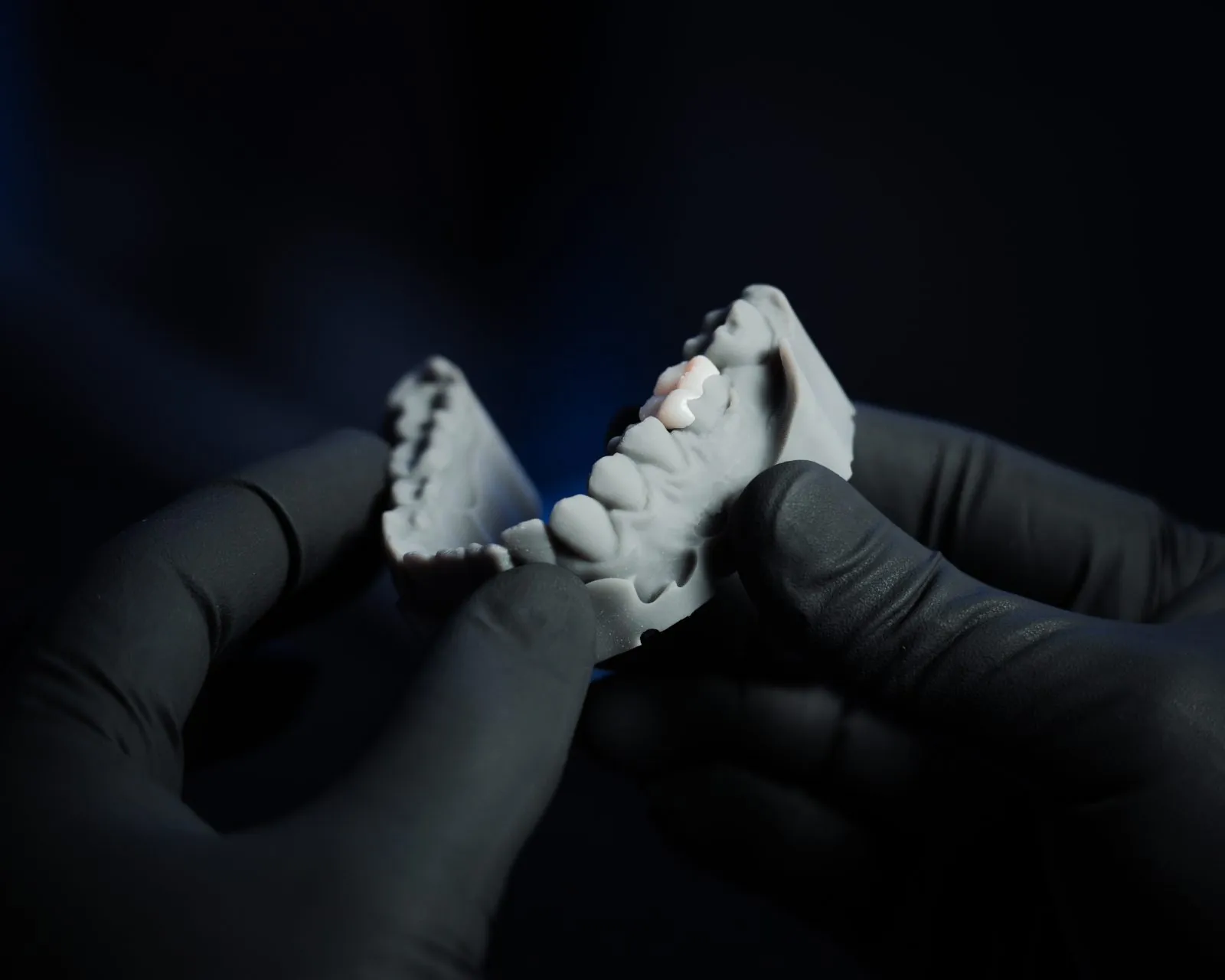 Modelos dentales impresos en 3D